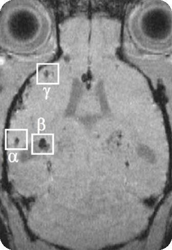 磁敏感成像.png 磁敏感成像.png