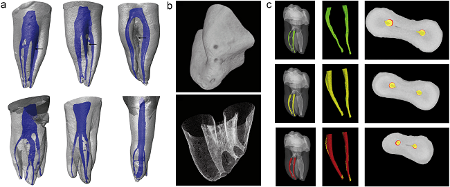 牙齒結(jié)構(gòu)研究 - 小.png 牙齒結(jié)構(gòu)研究 - 小.png