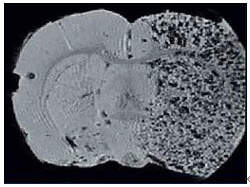 分子影像成像.png 分子影像成像.png