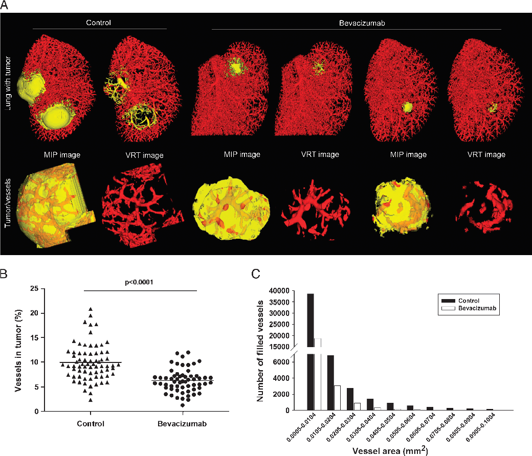 肺部研究-2.png 肺部研究-2.png