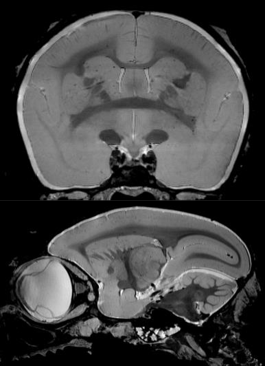 猴腦成像.png 猴腦成像.png
