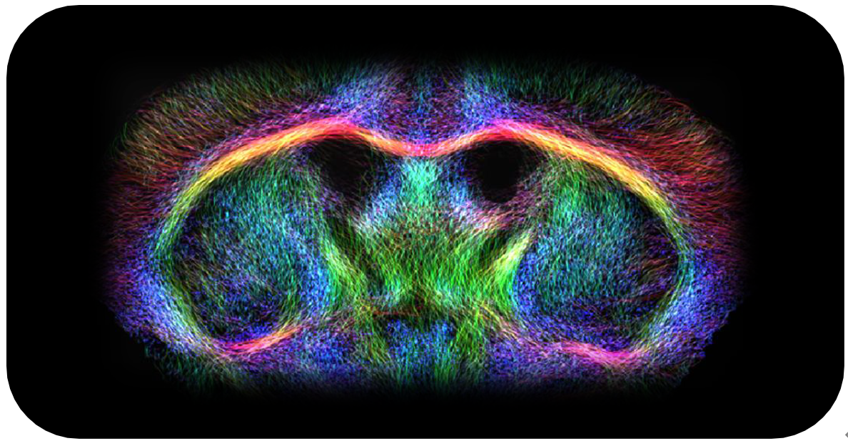 小鼠腦部擴散張量成像.png 小鼠腦部擴散張量成像.png