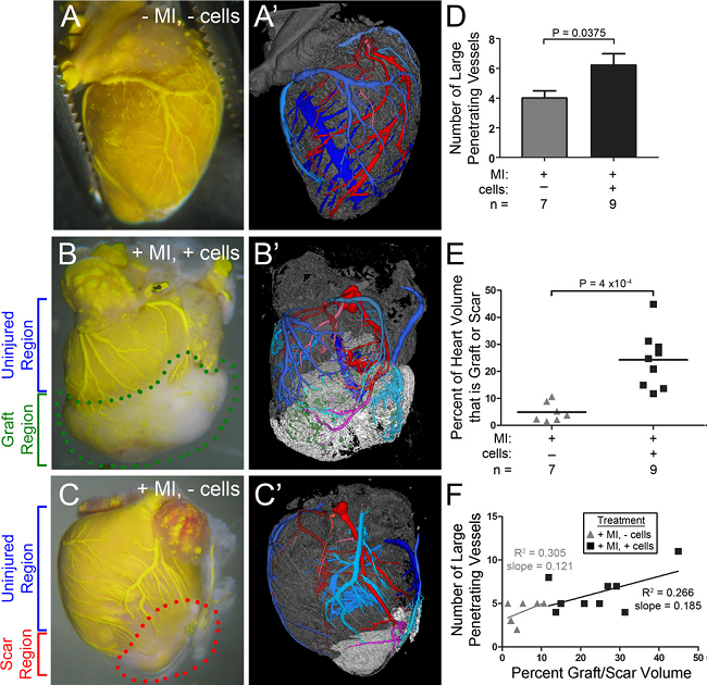 心梗模型研究 - 小.png 心梗模型研究 - 小.png