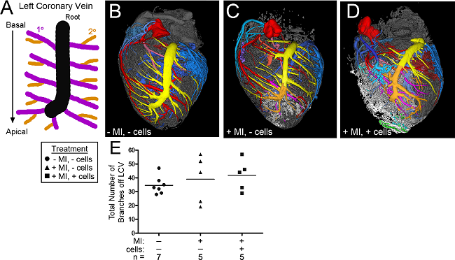 心梗模型研究 - 2 - 小.png 心梗模型研究 - 2 - 小.png
