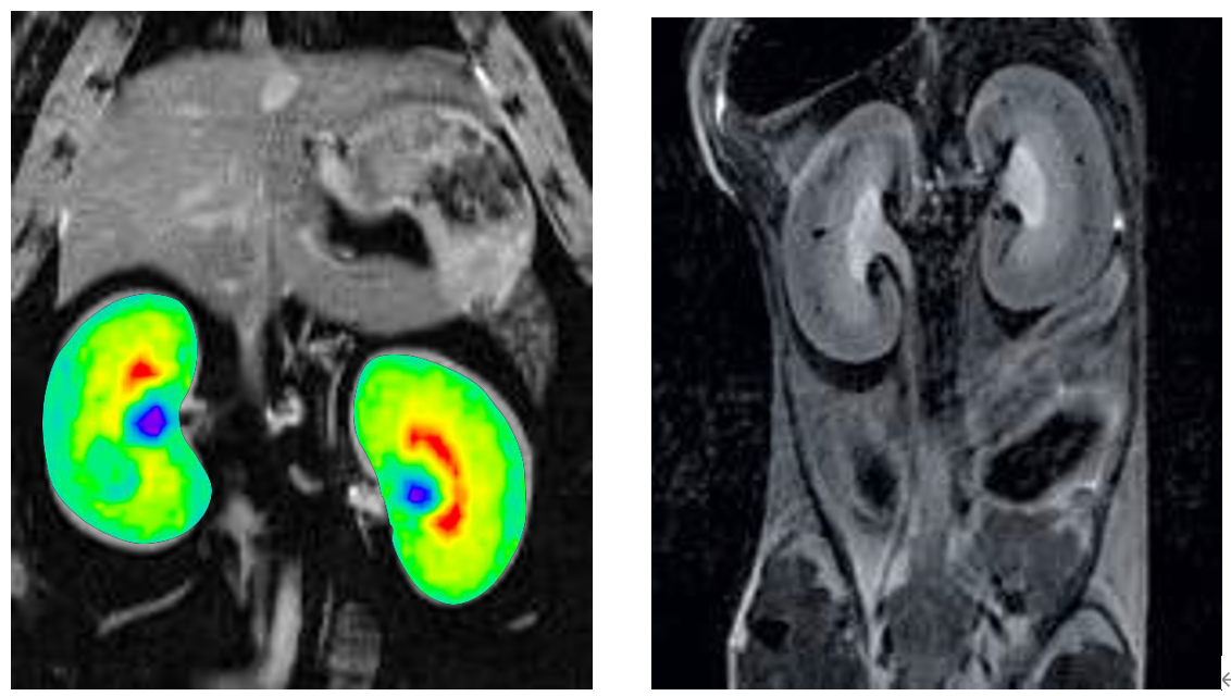 腹部成像.png 腹部成像.png