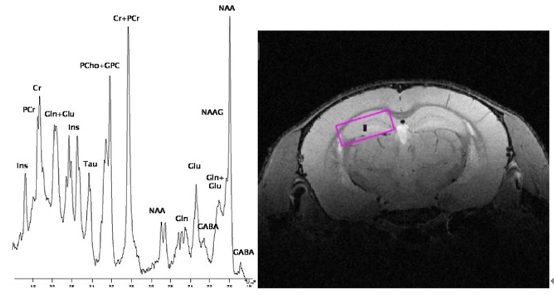 高強磁場下的磁共振波譜.png 高強磁場下的磁共振波譜.png
